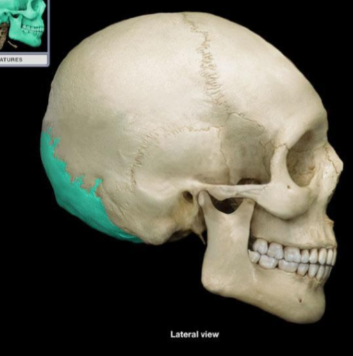 <p>What bone is this?</p>