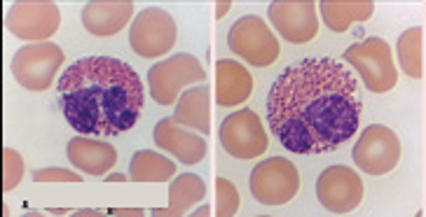 <p>granulocyte that stains bright red</p><p>- participates in allergic reactions</p><p>- responds to parasitic infections</p>