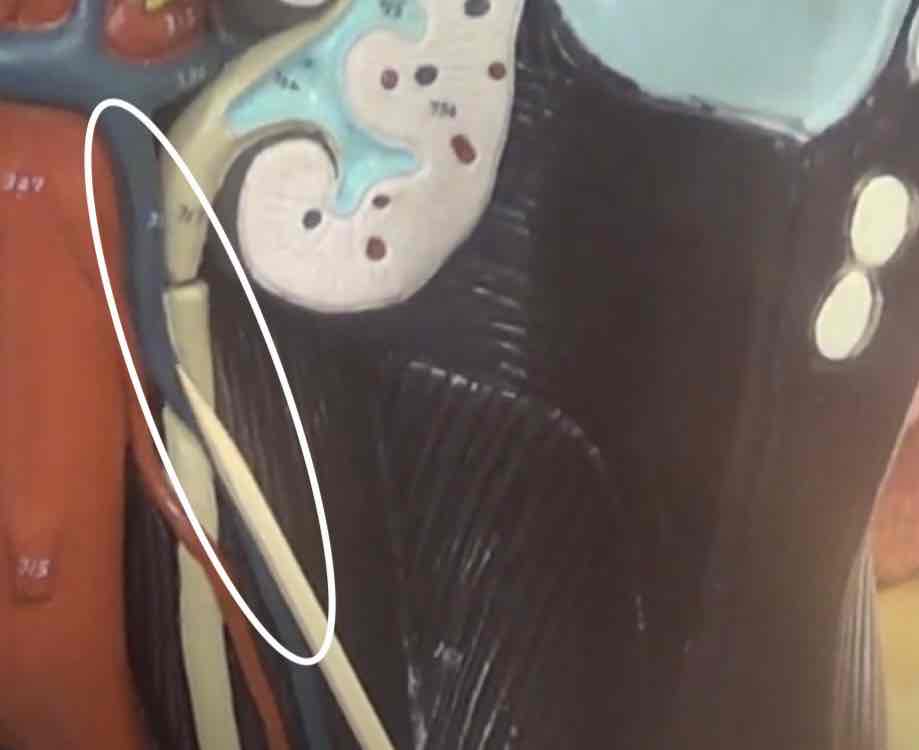<p>what is this? (torso model)</p>