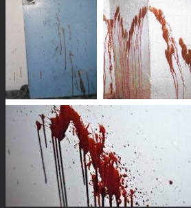 <p>Projected Blood (arterial spurt)</p>