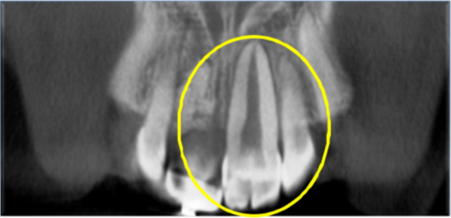 <p>Incisors and canines</p>