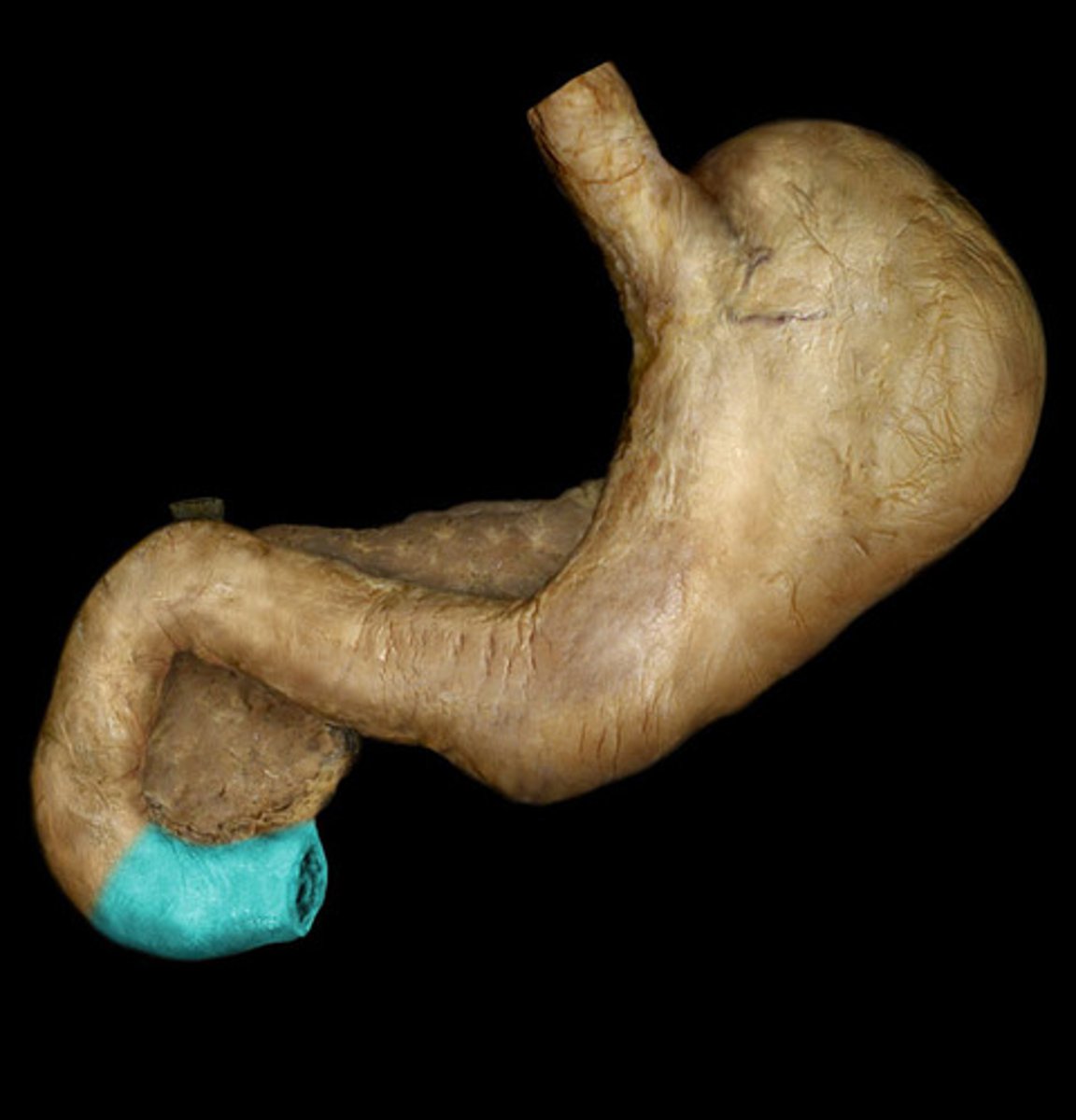 <p>Portion</p><p>- Below the head of pancreas</p><p>- Bends 90 degrees</p>