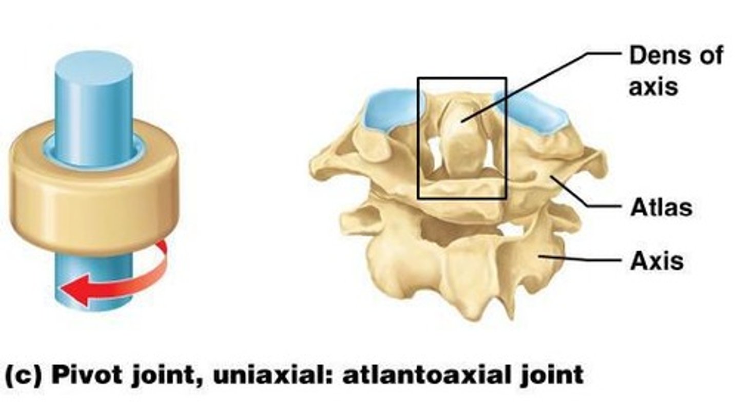 <p>round/pointed bone articulates with a ring formed by a bone/ligament, monoaxial</p>
