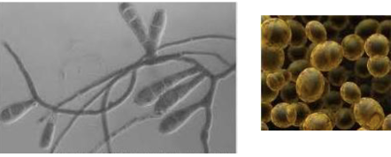 The pictures shown here represent the same organism at different stages in its life cycle. What is the organism?