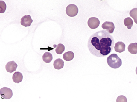 <p>what type of RBC abnormality is this</p>