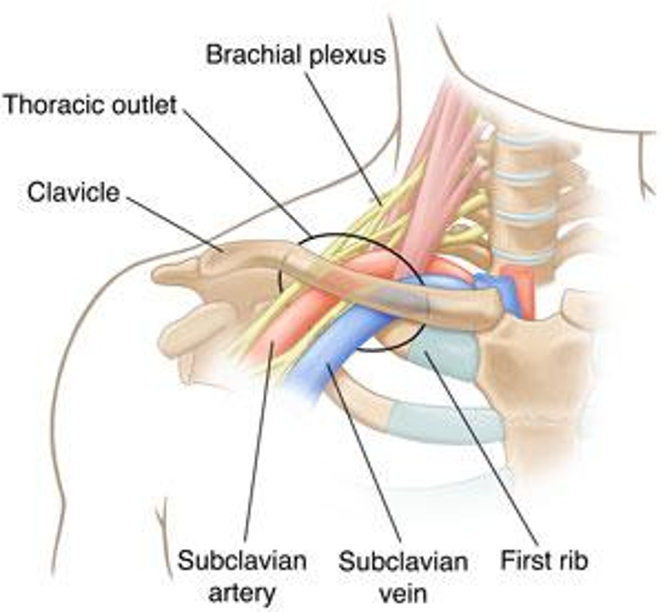 <p>A neurovascular disorder resulting from idiopathic compression of the neurovascular bundle in the interval between the neck and axilla.</p>