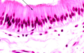 <p><span style="background-color: transparent; font-family: "Book Antiqua", serif;"><span>Protective layer on internal surface of organs (stomach, intestines, gallbladder)<br></span></span></p>