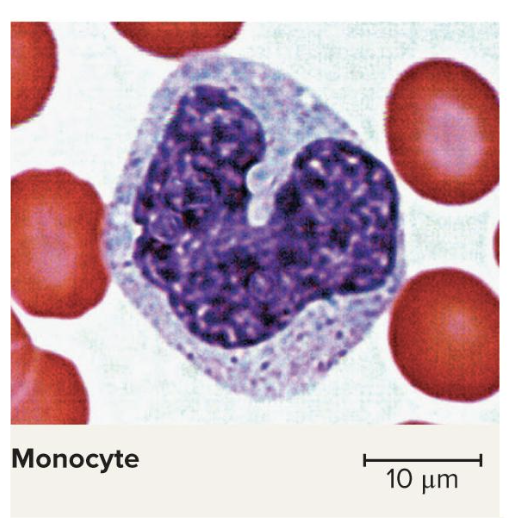 <ul><li><p>increased number of them in viral infections and inflammation</p></li><li><p>Very large, 2-3x the diameter of erythrocytes</p></li><li><p>have a horseshoe or C-shaped nucleus</p></li><li><p>Leave bloodstream and transform into macrophages</p><ul><li><p>these go around swallowing things that do not belong there</p></li><li><p>will only swallow if its been covered in antibodies</p></li><li><p>“Present” antigens to activate other immune cells—antigen-presenting cells (APCs)</p></li></ul></li></ul><p></p>