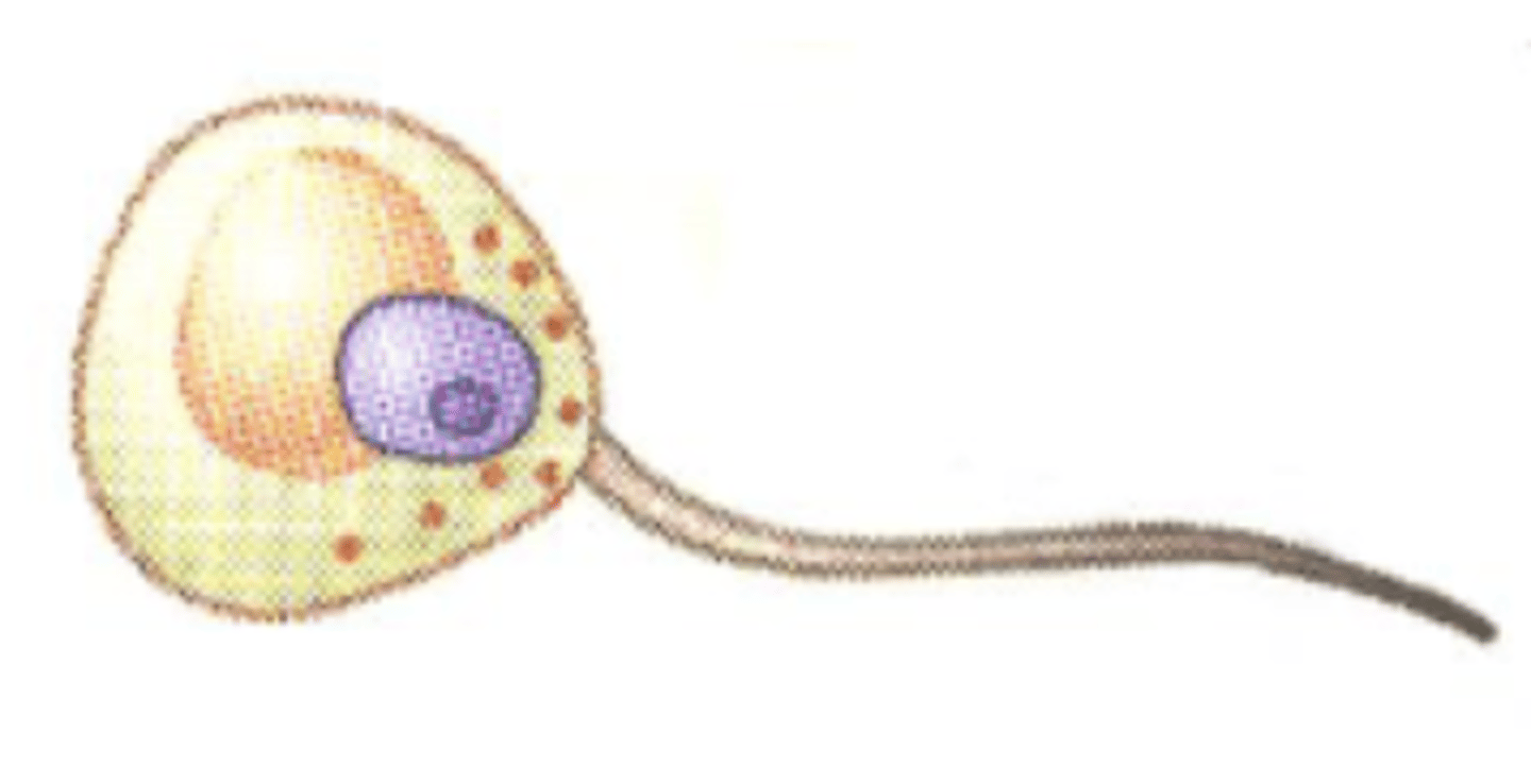 <p>Flagellated spores (Zoospores)</p>