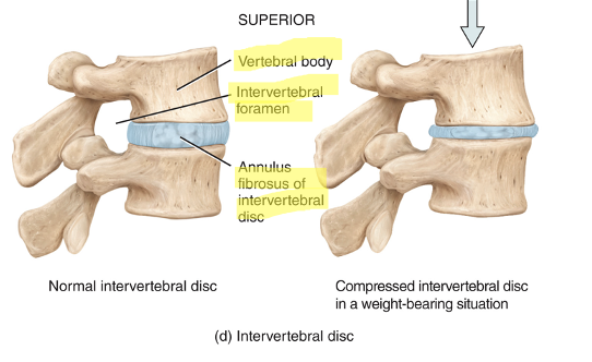 <p>between the bodies of the vertebrae from the second cervical to the sacrum; absorb shock and separate the vertebrae from one another</p>