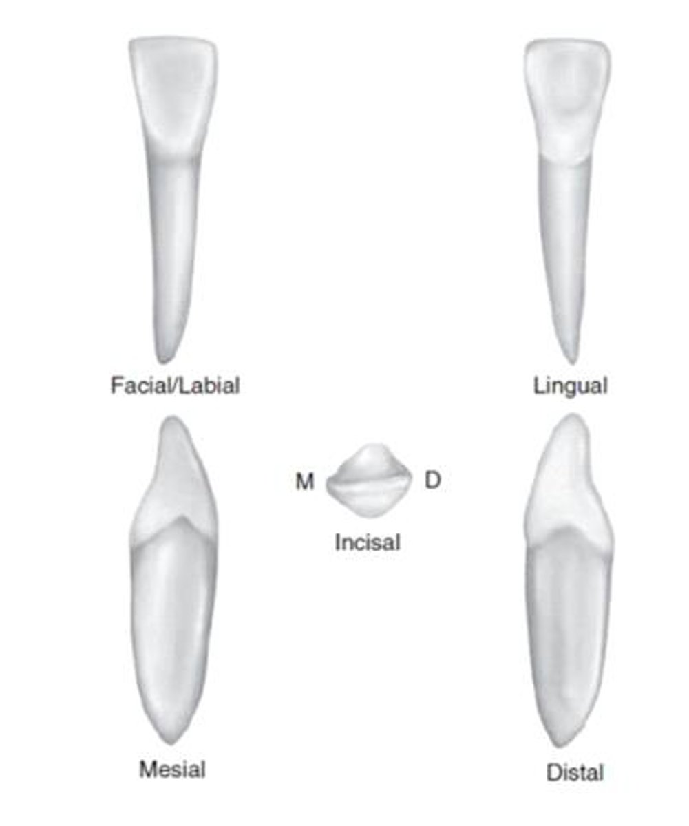 <p>what tooth is this?</p>