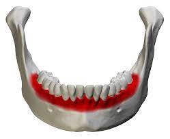 <p>small raised areas between the teeth (lower)</p>