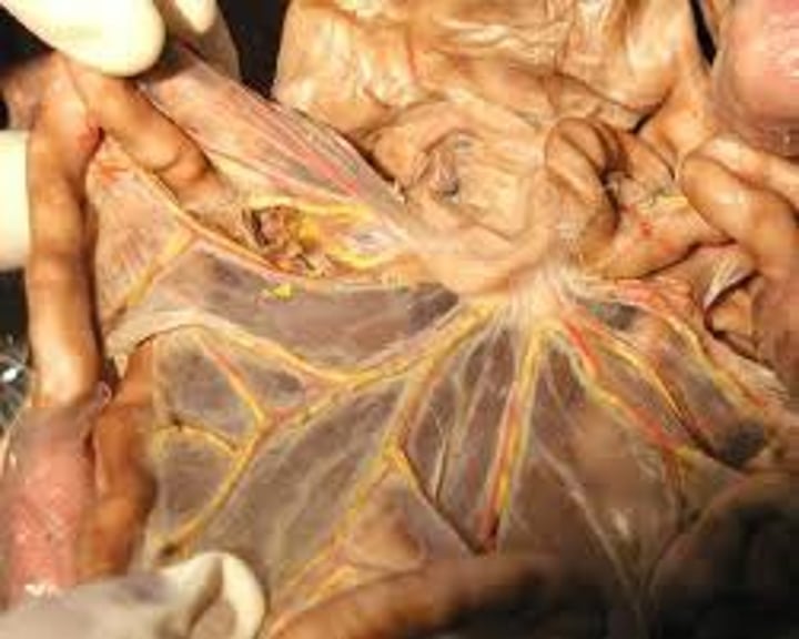 <p>a fold of the peritoneum that attaches the stomach, small intestine, pancreas, spleen, and other organs to the posterior wall of the abdomen.</p>