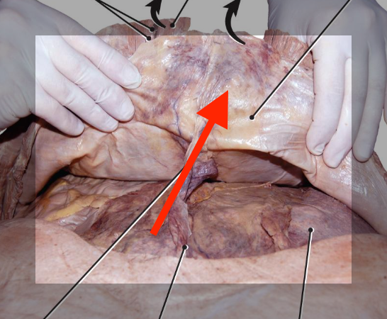 <p>lines the abdominal cavity</p>