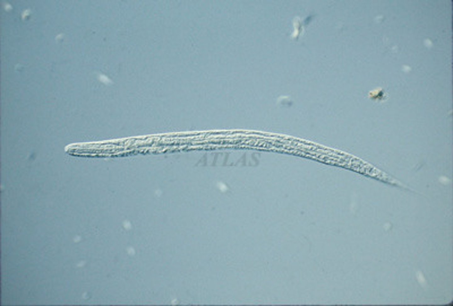 <p>380x20um</p><p>Short buccal cavity</p><p>Prominent genital primordium</p><p>Short tail</p>
