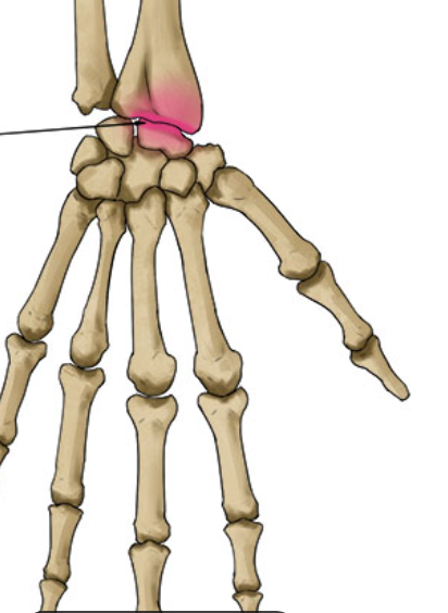 <p>Oval surface fits into depression; ex: wrist.</p>