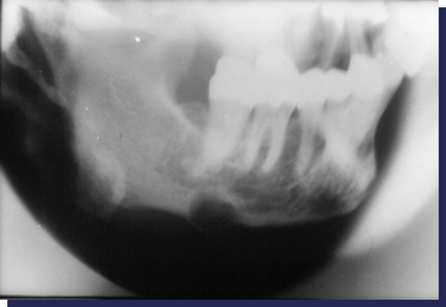 <p>Brown tumors are associated with _______</p>