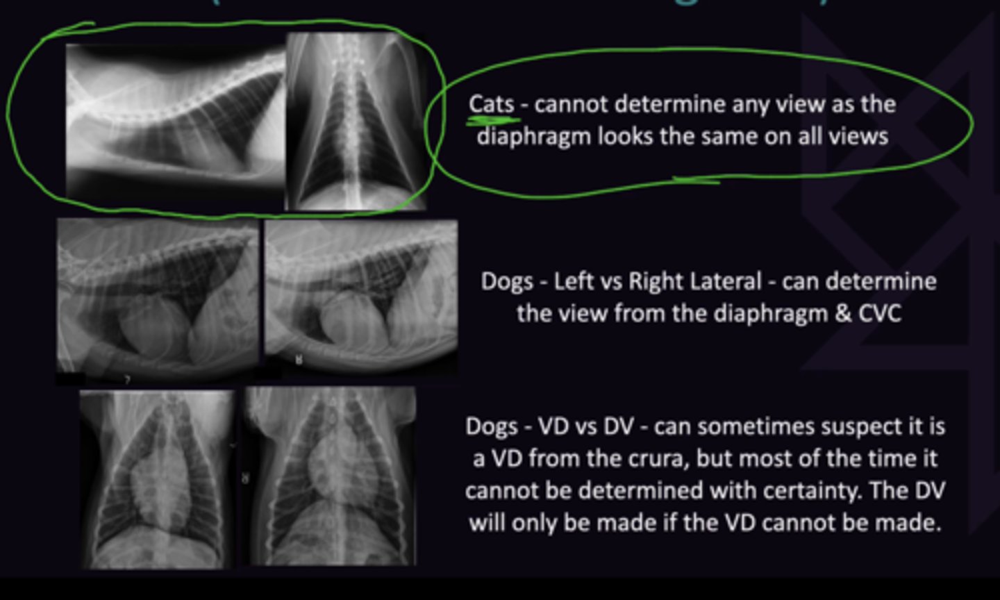 <p>1. Cannot determine any views as the diaphram looks the same on all views</p><p>2. Can determine the view from the Diaphragm + CVC</p><p>3. Can sometimes suspect it is VD from crura, but cannot be certain. DV will only be made if VD cannot be made</p>