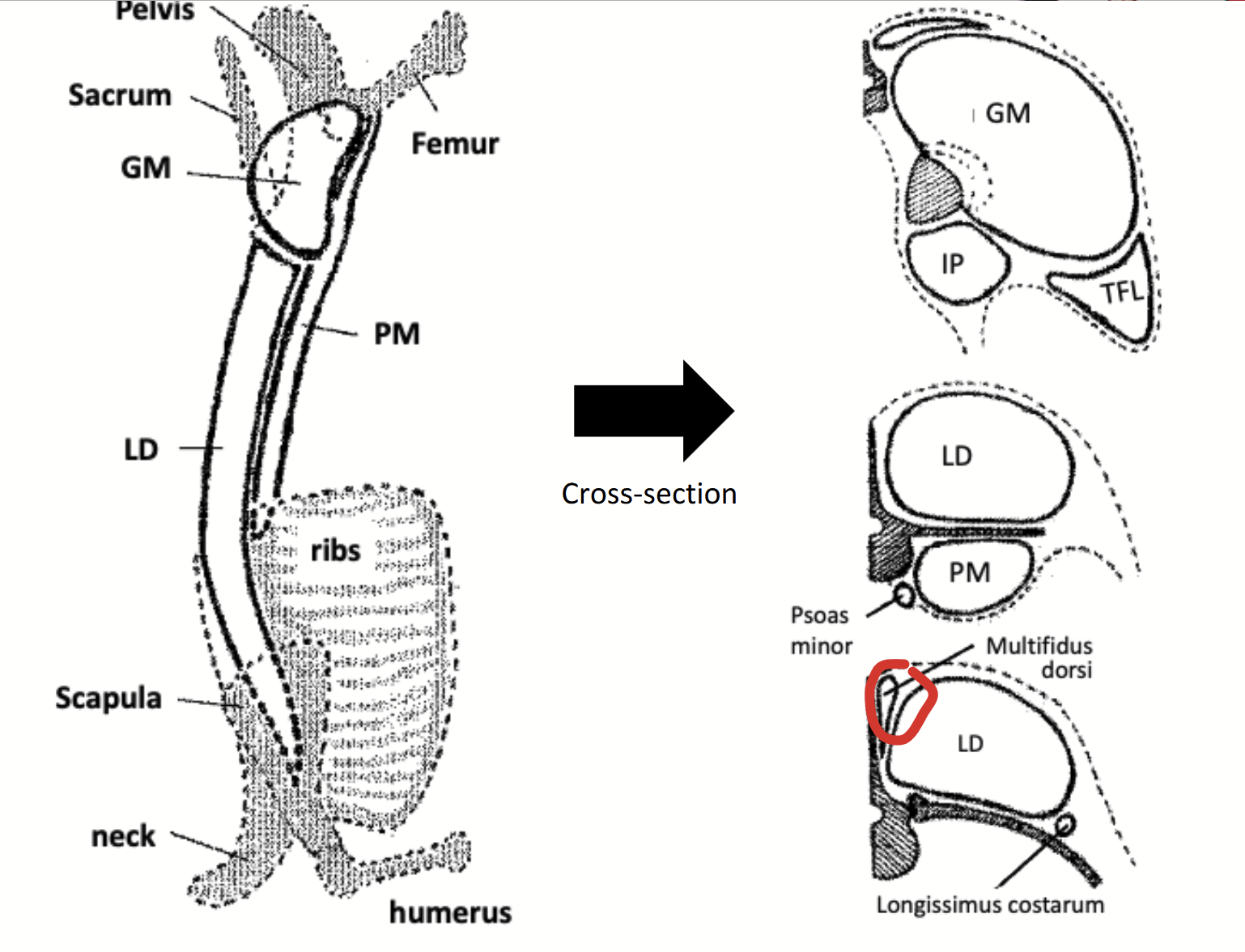 <p>Muscles found immediately lateral to the dorsal spines of the vetebrae (medial to the longissimus dorsi).</p><p>Has little commercial significance due to its small size, but may create a problem in the measurement of rib eye areas since they might be accidentally included with the longissimus dorsi.</p>