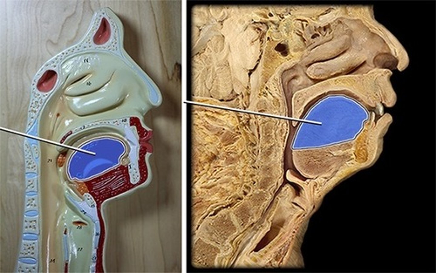 <p>What part of the digestive system is this?</p>