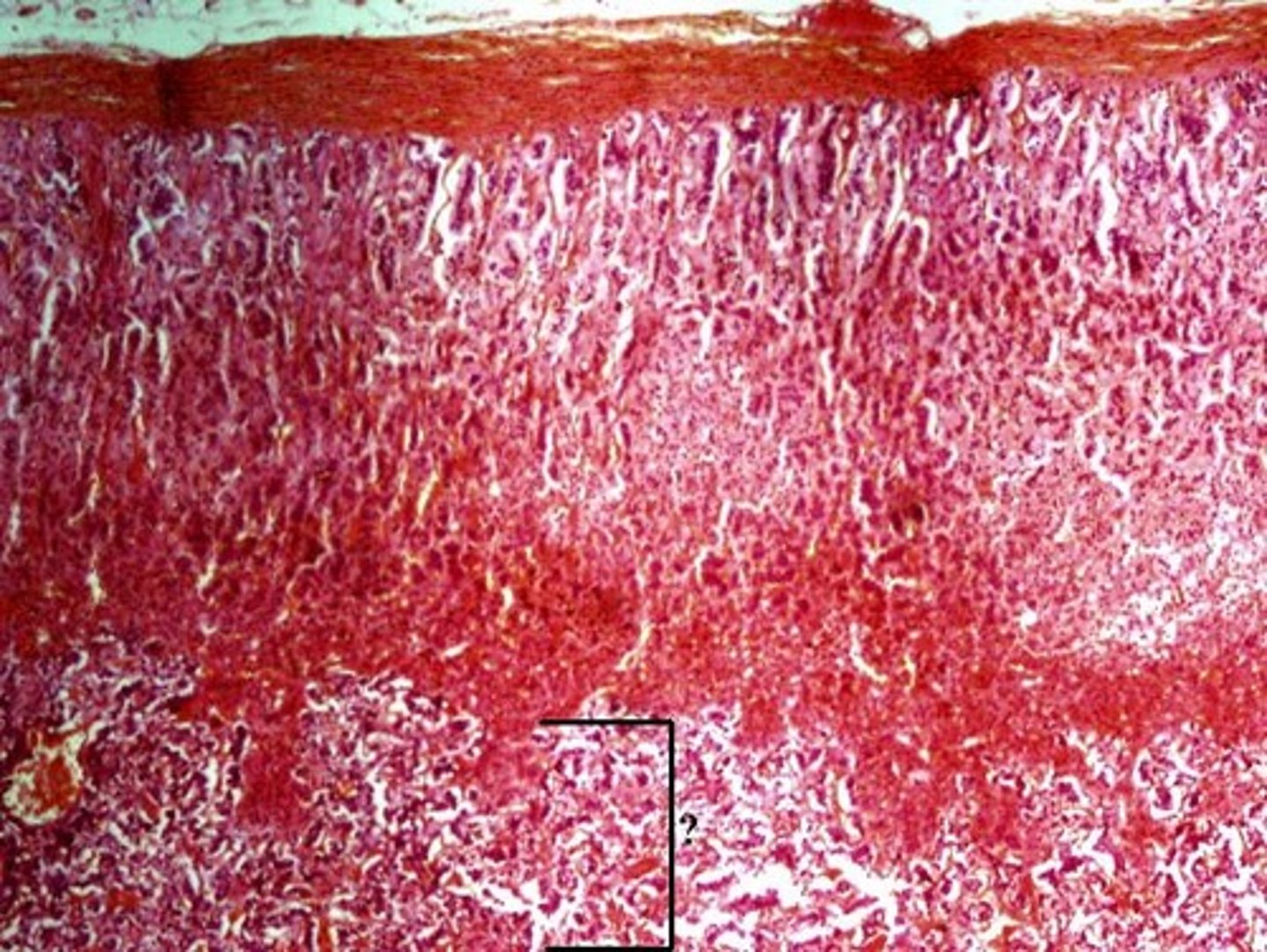 <p>medula</p>
