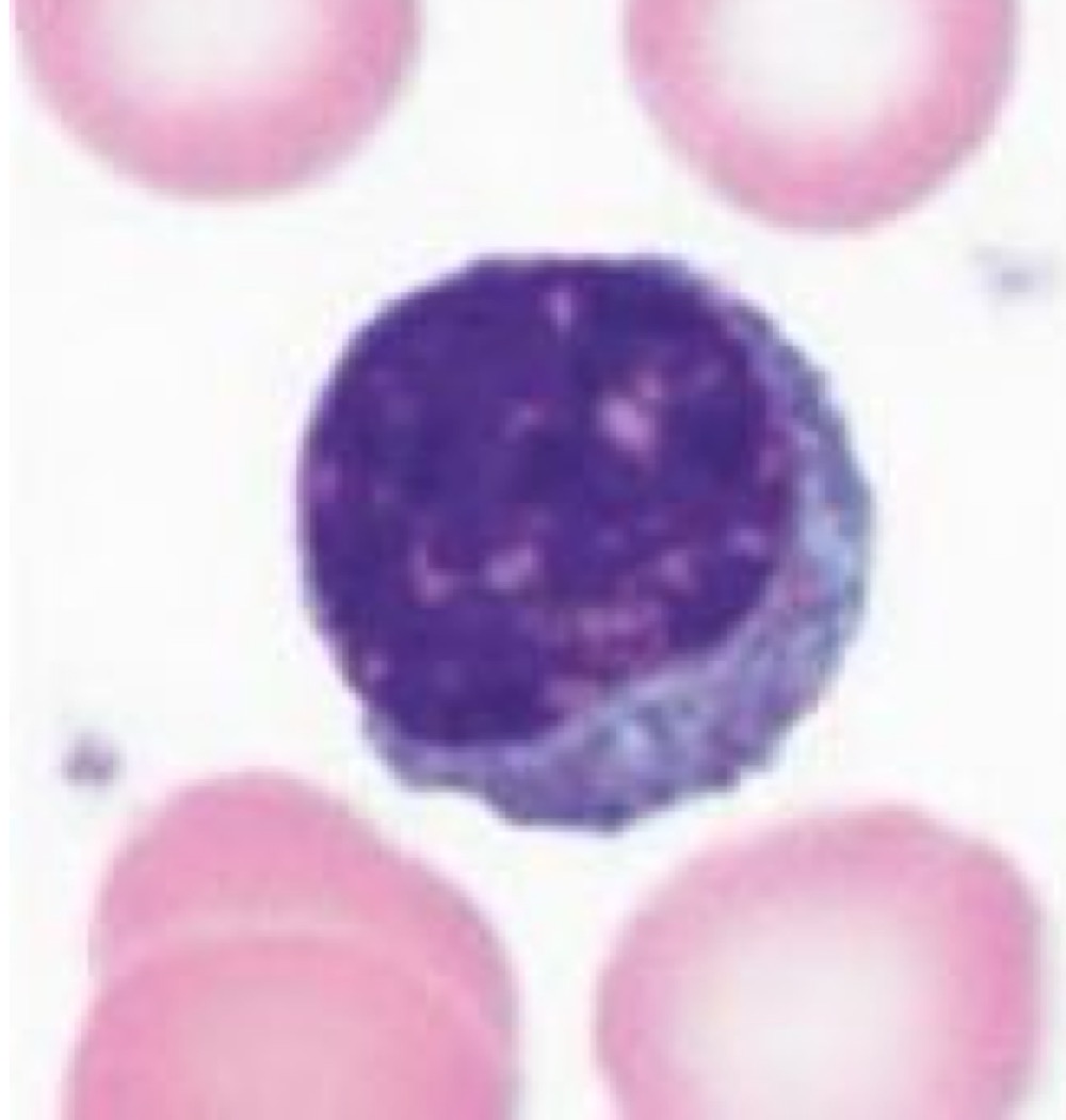 <p>Lymphocytes </p>