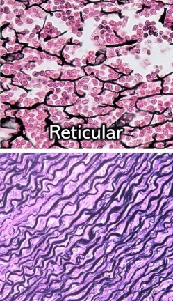 <p>Which connective tissue is this?</p>