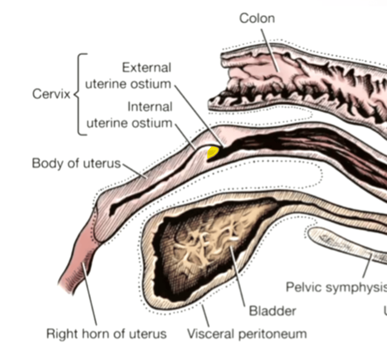 <p>The extension of cervix into vagina, surrounded by vaginal fornix.</p>