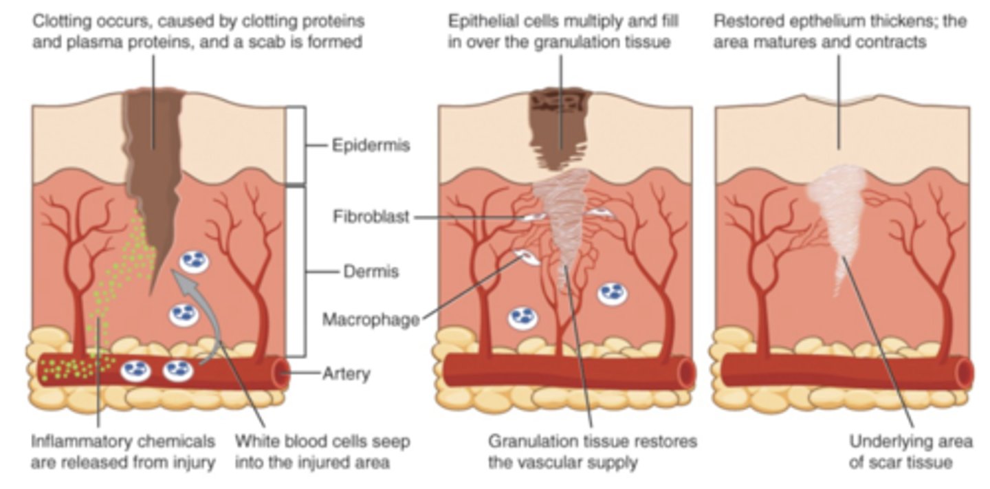 <p>Appropriate stress is key!</p><p>- After 2 years is typical for return to normal</p><p>- i.e. Incision after hip replacement surgery</p>
