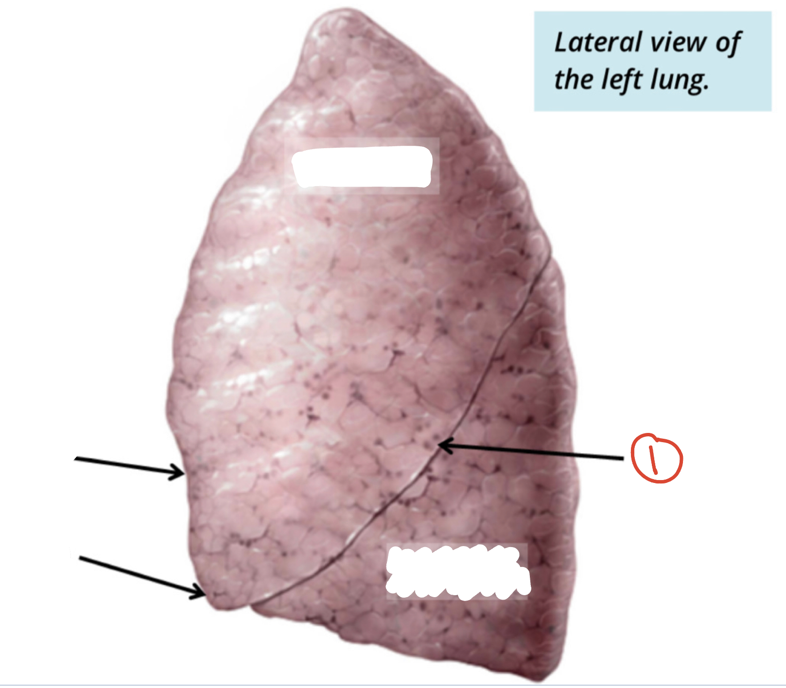 fissures of left lung (1)