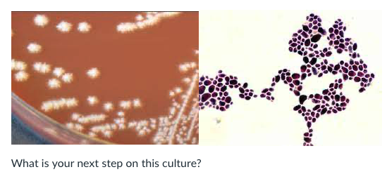 <p>A vaginal culture grew the following organism:&nbsp;&nbsp;</p><p>&nbsp; &nbsp;&nbsp;</p><p>What is your next step on this culture?</p><p>&nbsp;</p><p>Report as normal flora</p><p>&nbsp;</p><p>Set up a germ tube to identify the yeast</p><p></p><p>Report as possible Neisseria isolated</p><p></p><p></p><p>Report as gram positive cocci isolated</p><p><br></p>