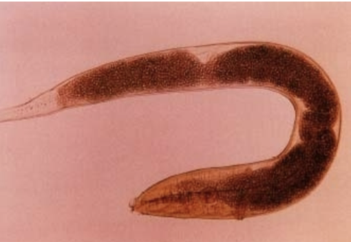 <p>Enterobius vermicularis</p>