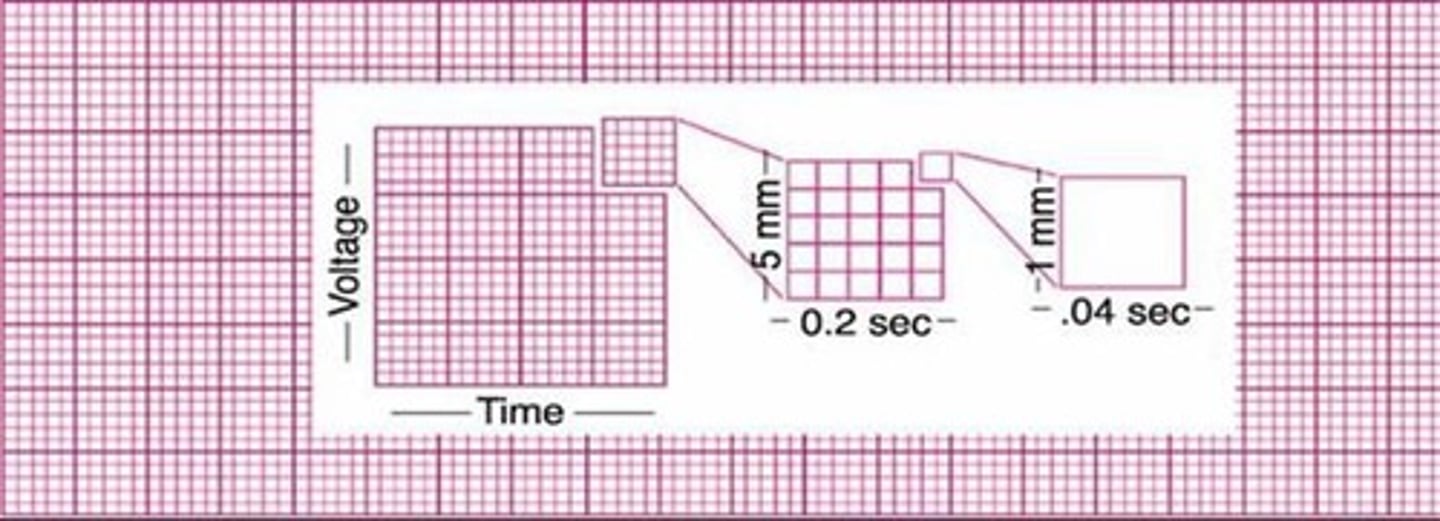 <p>a grid permitting time management along the horizontal lines, and voltage measurement along the vertical lines</p>