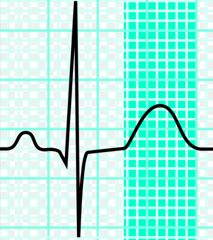 <p>final small peak, ventricular repolarization, highlighted region</p>