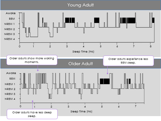 <ul><li><p>You sleep mostly as a baby, mostly in REM (16 hours)</p></li><li><p>Old: More waking moments, less deep sleep, less REM sleep (overall worse) </p></li></ul><p>You sleep less over time and less REM sleep - there are always individual differences</p><ul><li><p><span><span>adenosine cannot be cleared, and your adenosine load increases</span></span></p></li></ul><p></p>