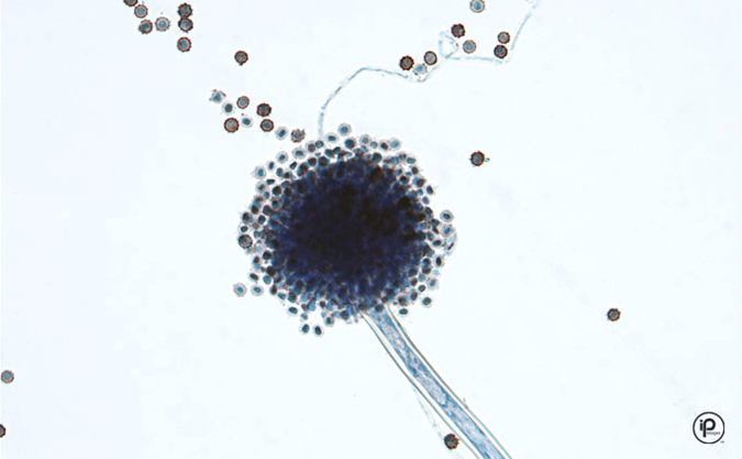 <p>Hyaline/Septate</p><p>Salt and pepper/white</p><p><em>Biseriate </em>phialides all around vesicle, dark round conidia </p><p>Number one cause otomycosis </p>