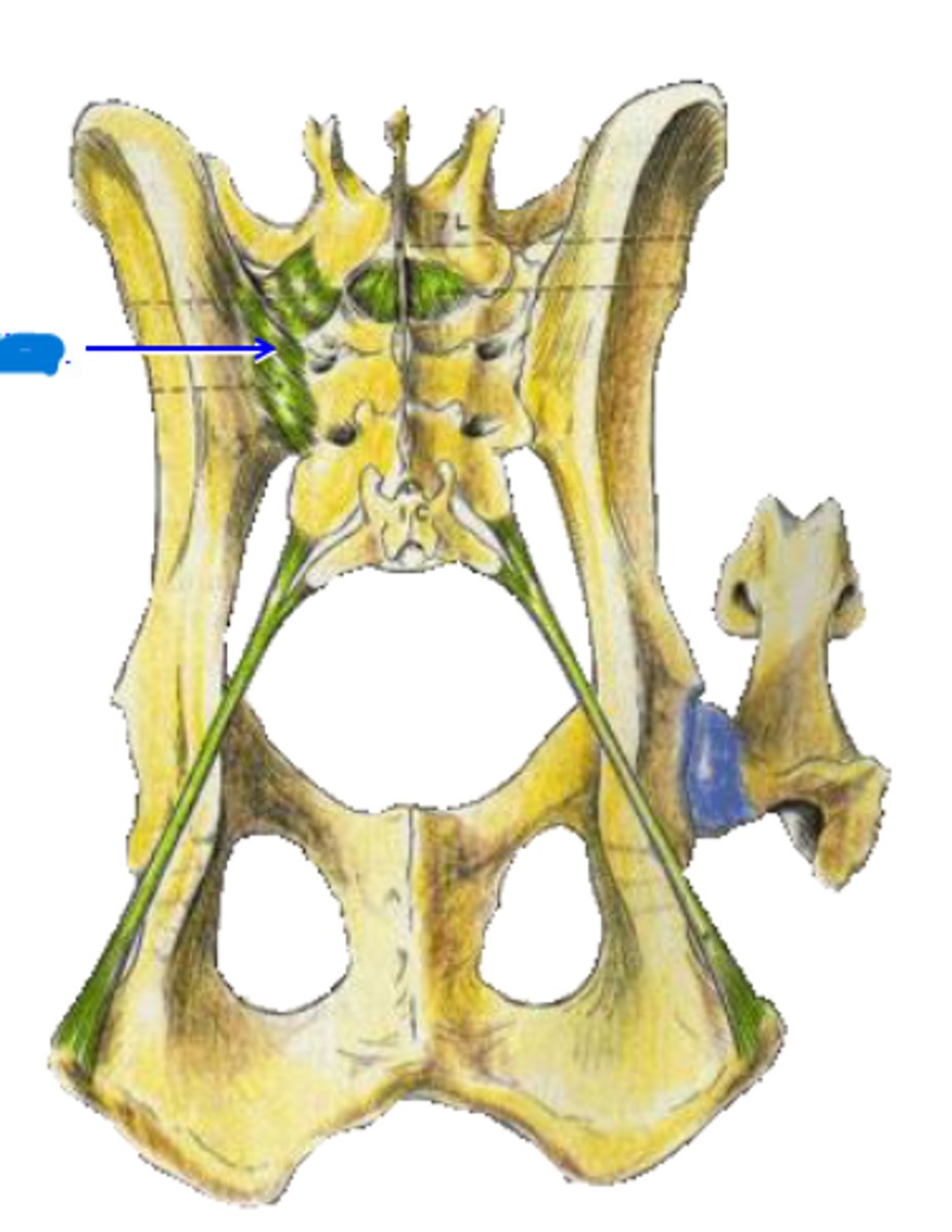 <p>What is the blue arrow pointing to?</p>