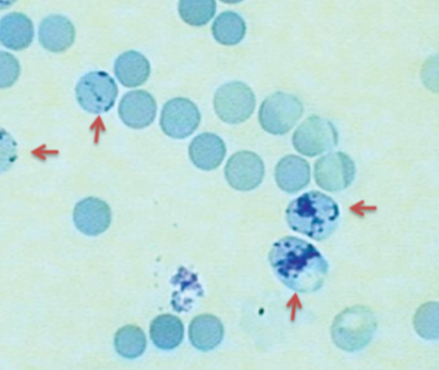 <p>are slightly immature, anucleate red cells that contain rna</p>