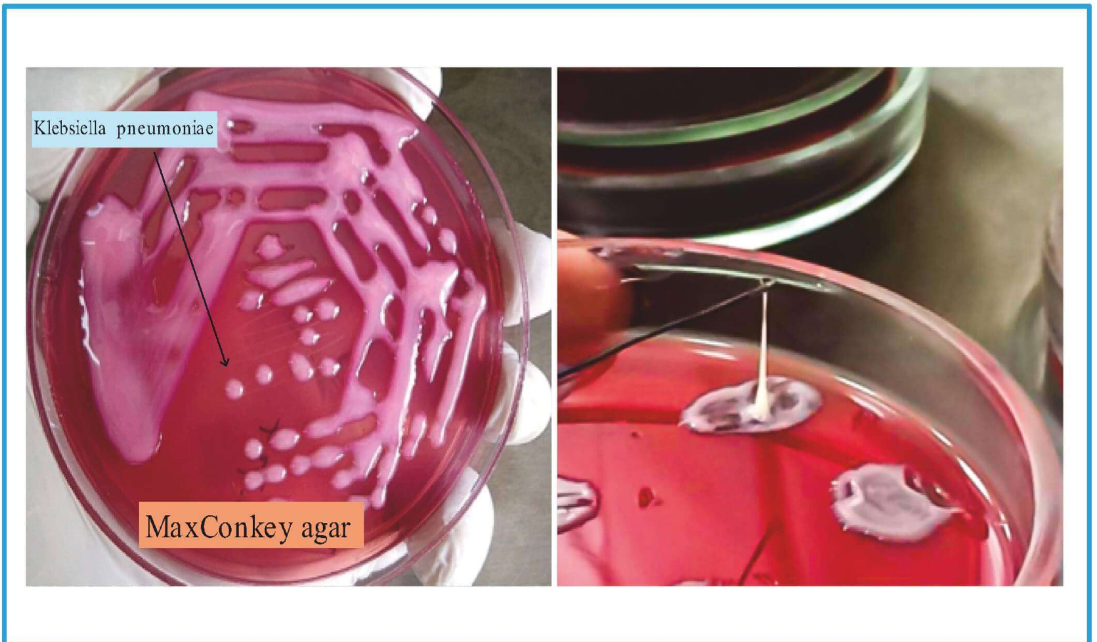 <p>Diagnosis & Treatment</p>