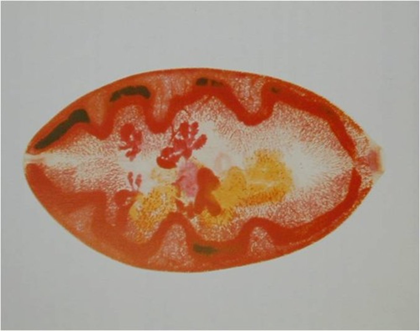 <p>This helminth usually occurs in pairs inside cysts in the lung parenchyma.</p>