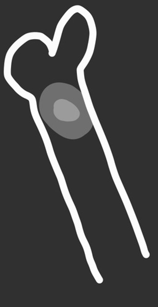 <p>patient is young and this is painful what tumour does this represent?</p>