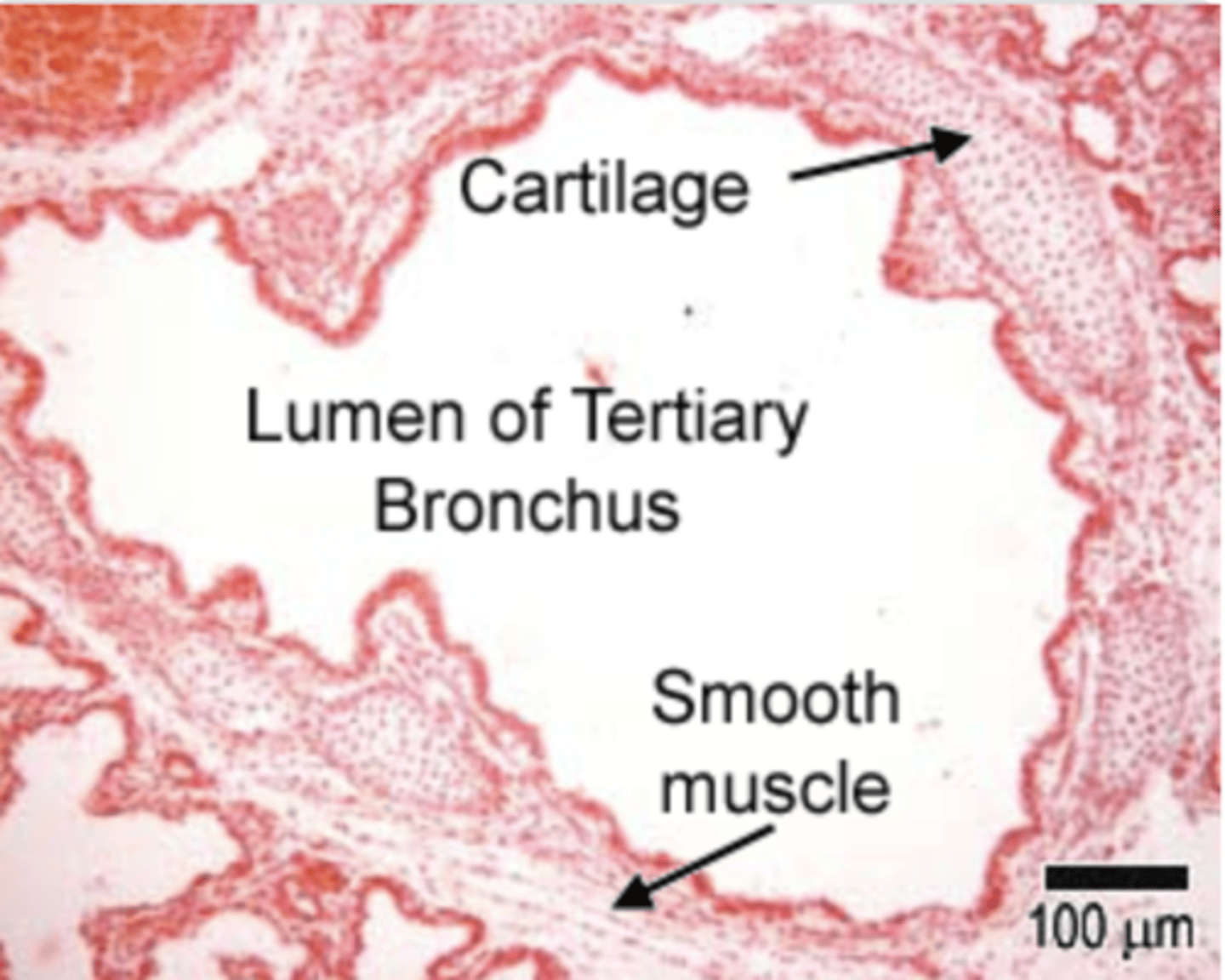 <p>. Bronchi have plates rather than rings of cartilage</p><p>.Present a layer of smooth muscle between lamina propria and submucosa</p><p>. There is less cartilage, and it does not completely encircle the lumen, as shown diagramatically above.</p>