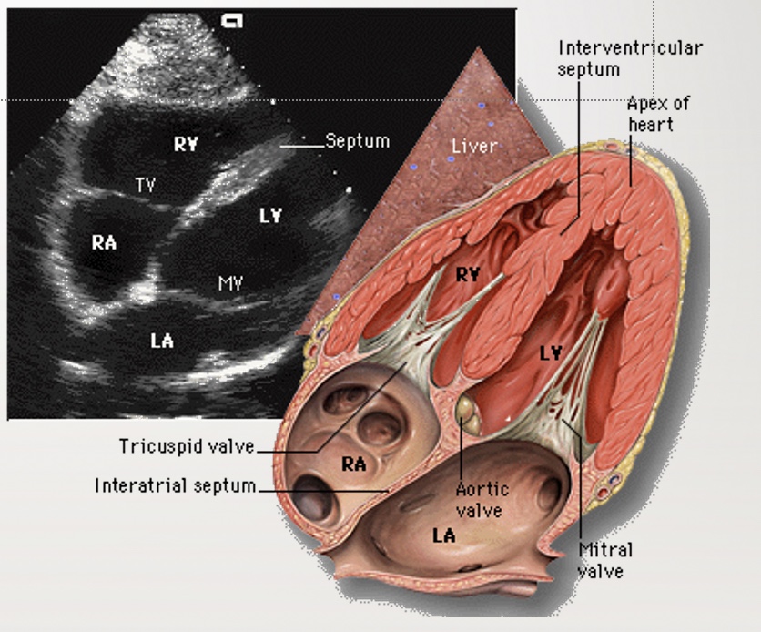 <p>Subcostal 4 chamber (SC4C)</p>