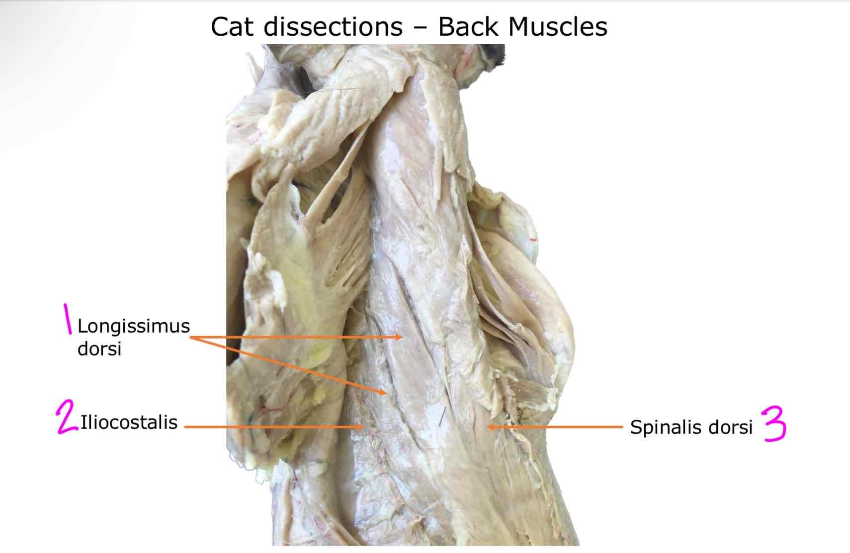 <ol><li><p>Longissium dorsi</p></li><li><p>Iliocostalis</p></li><li><p>Spinalis dorsi</p></li></ol>