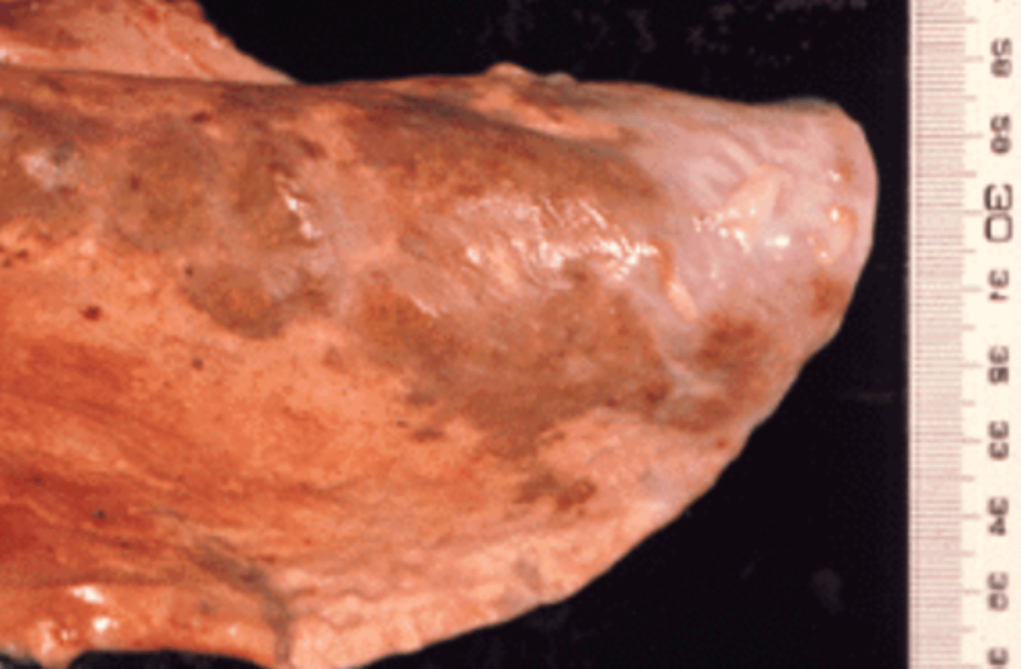 <p>sheep lung. which parasite has infected it? what is the name for this disease?</p>