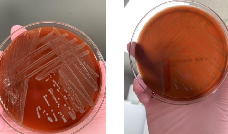 <p>lets say the gram stain showed GPC and was catalase (-) what should you do next</p>