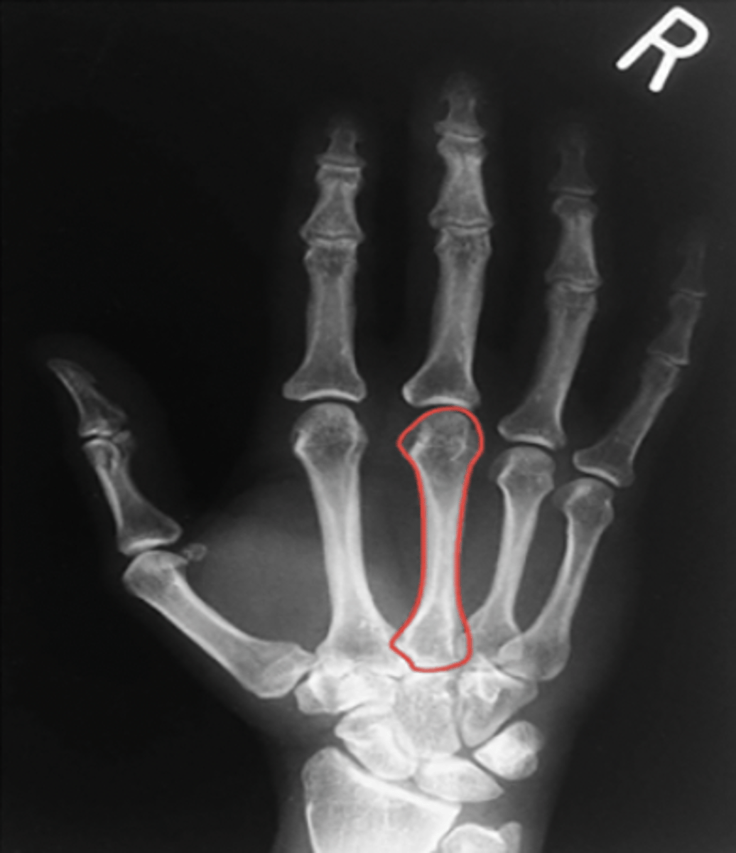 <p>What structure is highlighted?</p>