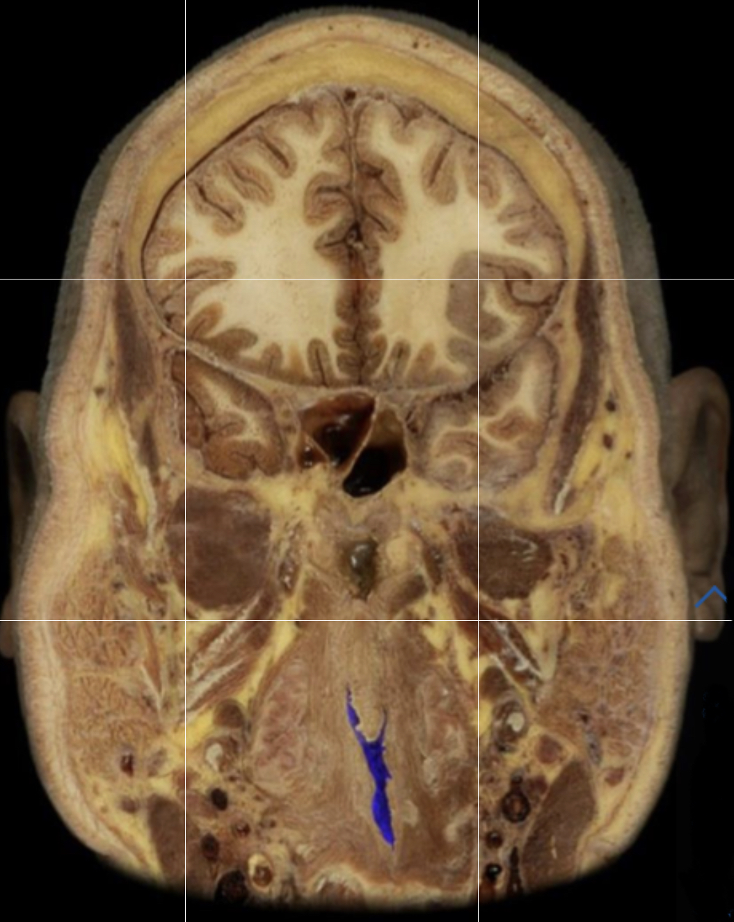 What structure is highlighted in blue?