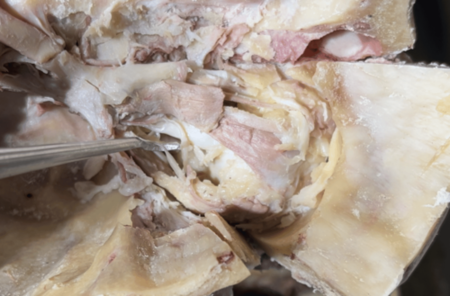 <p>The nerve running lateral to the eye is the</p>