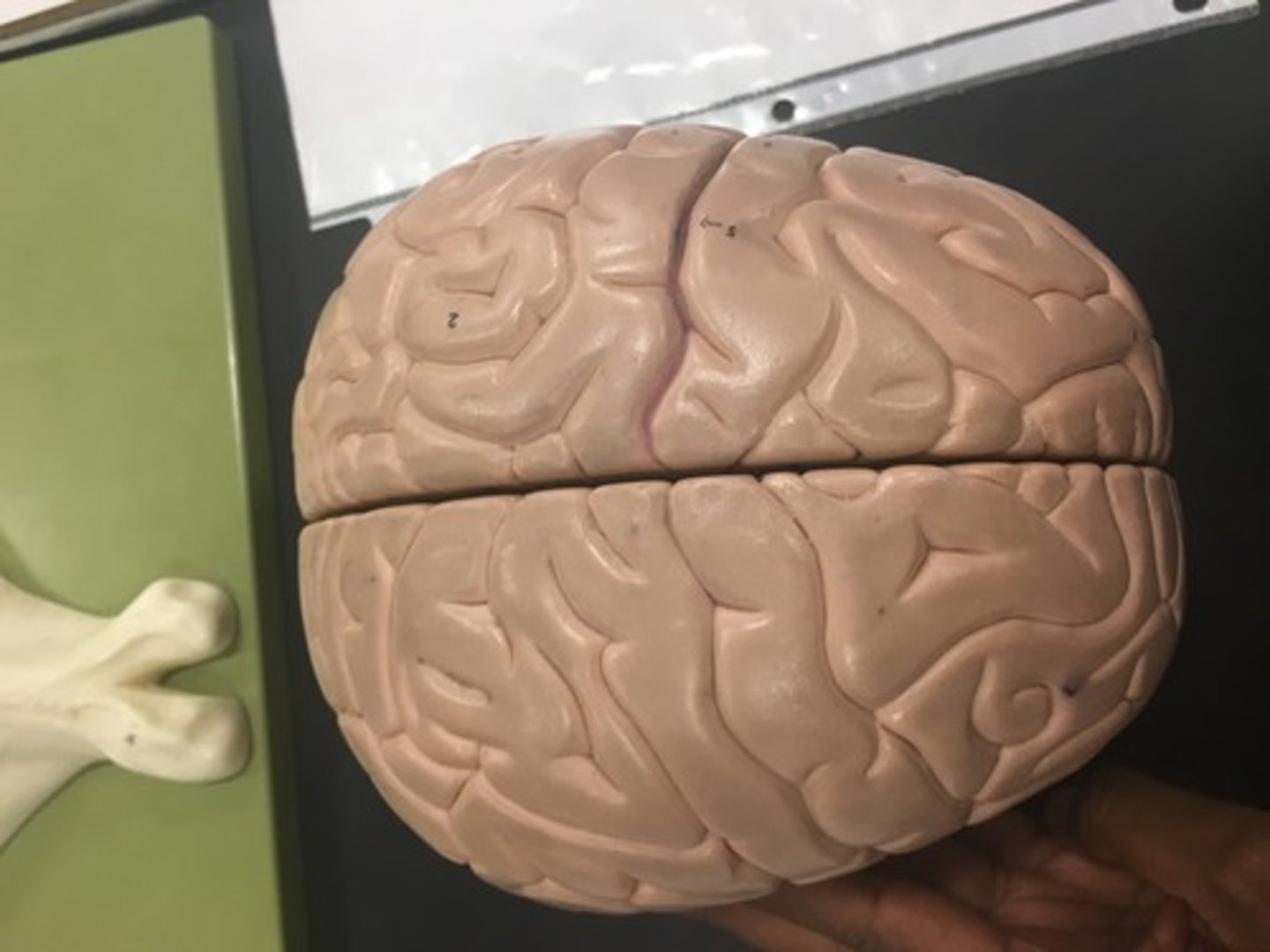 <p>Crease/line that divides the brain in to left and right side hemisphere.</p>